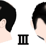 Ⅲ（ハミルトンノーウッド分類）