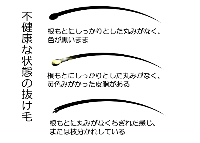 不健康な抜け毛